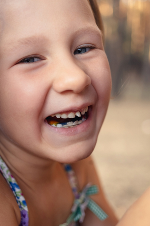 Little girl with orthodontics appliance and wobbly tooth.の写真素材