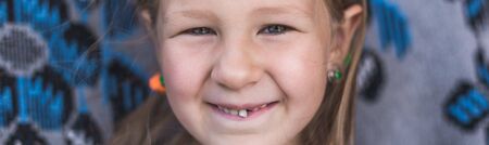 Dairy tooth fell out of the child. Little girl wobble loose tooth.の写真素材