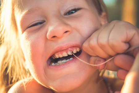 The process of removing a baby tooth using a thread.
