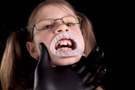 The doctor examines the child's teeth. A child with crooked teeth. Studio photo on a black background.の写真素材