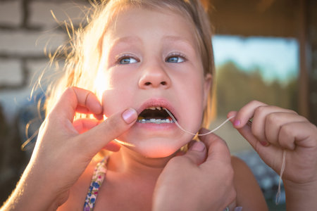 The process of removing a baby tooth using a thread.