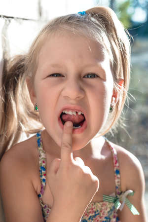 Little girl points the finger at a wobbly baby tooth.の写真素材