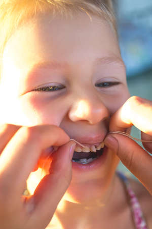 The process of removing a baby tooth using a thread.の写真素材