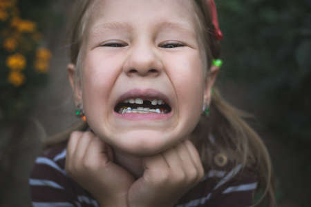 Child with a dental orthodontic device and without one tooth.の写真素材