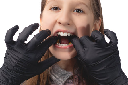 A doctor in black medical gloves tries on an orthodontic appliance for a little girl. The concept of teeth alignment in childhood. Studio photo on a white background.の写真素材