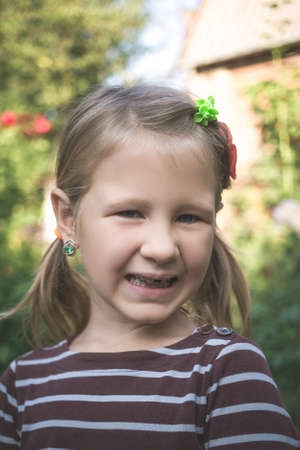Child with a dental orthodontic device and without one tooth.の写真素材