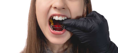 A doctor in black medical gloves tries on an orthodontic appliance for a little girl. The concept of teeth alignment in childhood. Studio photo on a white background.の写真素材