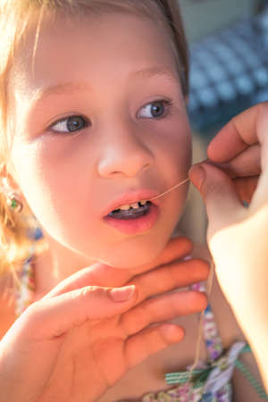 The process of removing a baby tooth using a thread.の写真素材