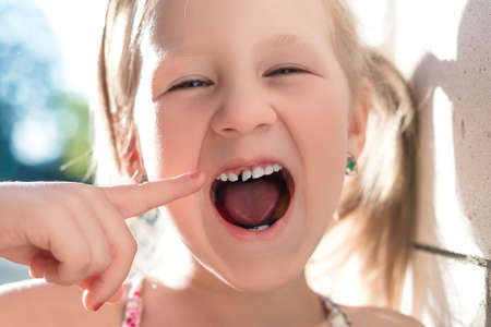 Little girl points the finger at a wobbly baby tooth.の写真素材