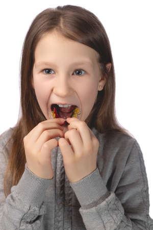 A cute little girl is putting on an orthodontic appliance. The concept of oral hygiene in childhood. Studio photo on a white background.の写真素材