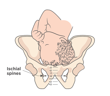 Child in womb w pelvis ischial spines medical illustrationのイラスト素材