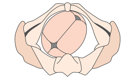 Left Occiput Anterior LOA Baby Fetal Position Pelvis | ROA Rightのイラスト素材