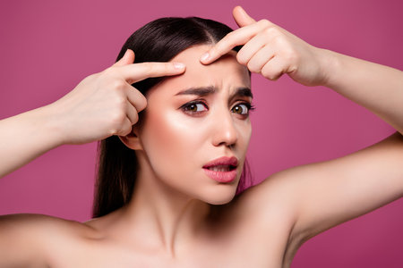 Photo of unhappy girl look touch face acne wrinkle isolated pastel color backgroundの写真素材