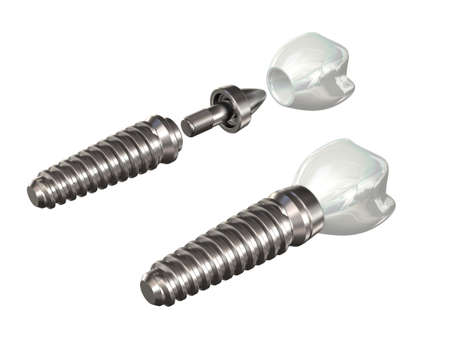 Very high resolution 3d rendering of a dental implant over whiteの写真素材