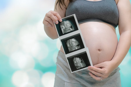 Young pregnant woman holding an ultrasound picture in front of her belly , isolated on bokeh background with space - Asian peopleの写真素材