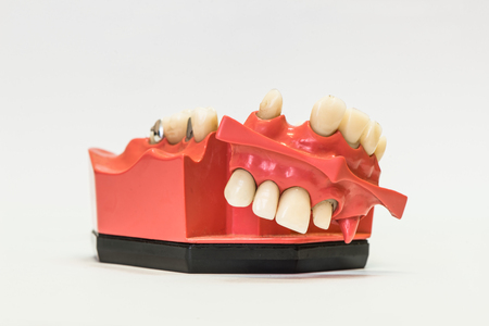 Dental phantom, dentures isolated on white backgroundの写真素材