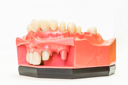 Dental phantom, dentures isolated on white backgroundの写真素材