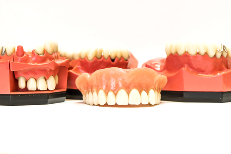 Dental phantom, dentures isolated on white backgroundの写真素材