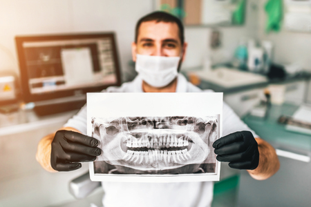 Doctor showing the x-ray of the patient in the dental clinicの写真素材