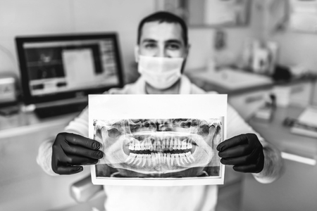 Doctor showing the x-ray of the patient in the dental clinicの写真素材
