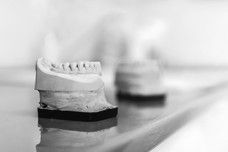 Dental gypsum model of the teeth in dental cliinicの写真素材