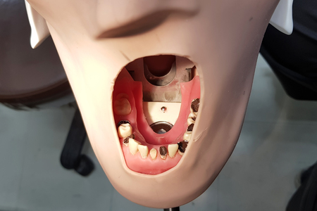 Dental model in phantom head for dental student to practice their skillの写真素材