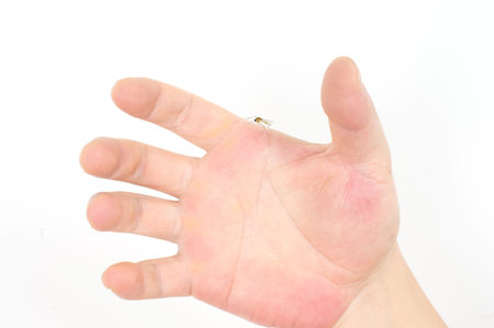 A blood-sucking mosquitoes are in the hands of people