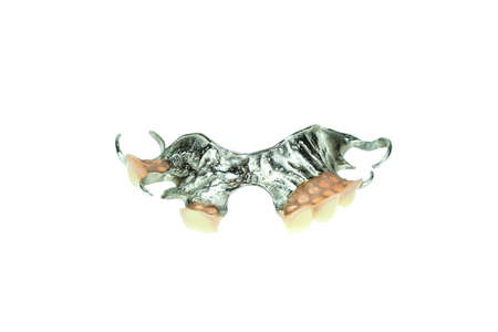 Removable partial denture for upper teeth isolated on white backgroundの写真素材