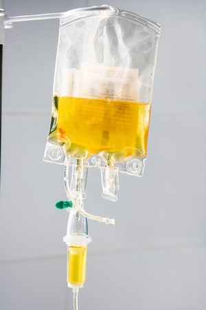 dropper with plasma transfusion in hospitalの写真素材