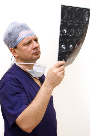 experienced doctor looking at tomogram in handの写真素材