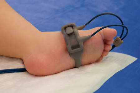 child's foot with oxymeter in ICUの写真素材