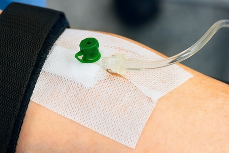 IV drip with cannula  catheter  in armの写真素材
