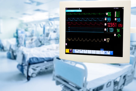 Electrocardiogram monitor in intensive care unit