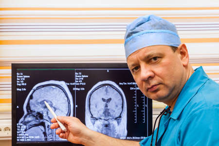Male doctor examining a brain cat scan at monitorの写真素材