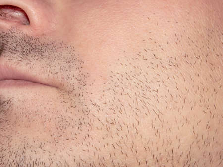 Unshaven stubble on a man's face.Part of an unshaven male face.Photo of male bristles.の写真素材