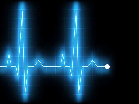 Electrocardiogram (EKG). EPS 8 vector file includedのイラスト素材