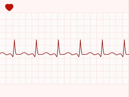 Normal electronic cardiogram. のイラスト素材