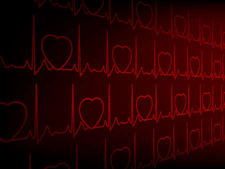 Cardiogram EKG.  のイラスト素材