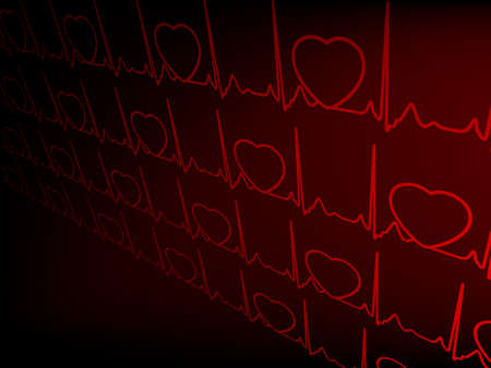 Cardiogram EKG. EPS 8 vector file included のイラスト素材