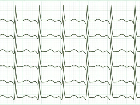 Fully editable and is located on a separate group heart cardiogram. 