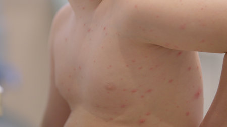 A child dealing with a skin condition chickenpox is captured in soft focus portraying their situationの写真素材