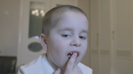 Child Opens His Mouth To Show Wiggling Baby Tooth. Child Showing His Milk Tooth Before Losing It....