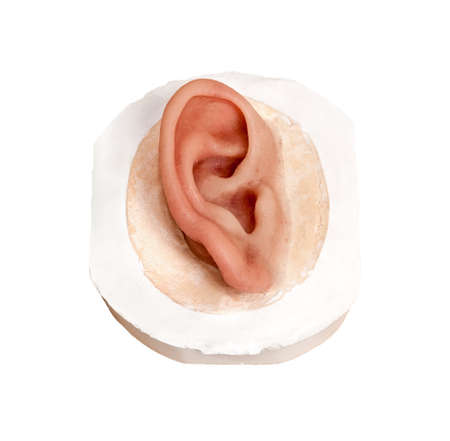 Human Facial Ear Prosthesis with Clip Closure. One Clip located behind Silicone Ear, the other is anchored in bone. Isolated on Whiteの写真素材