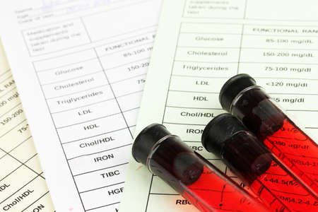 Blood in test tubes and results close upの写真素材