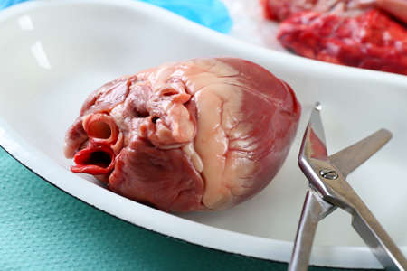 Heart organ in medical metal tray with tools on table close upの写真素材