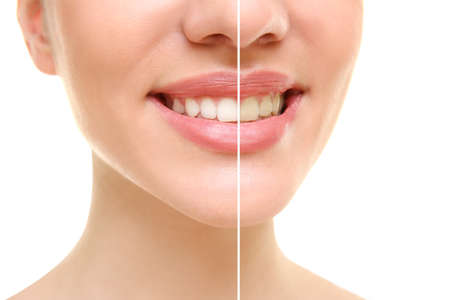 Result of teeth whitening. Smiling young woman on white background, closeupの写真素材