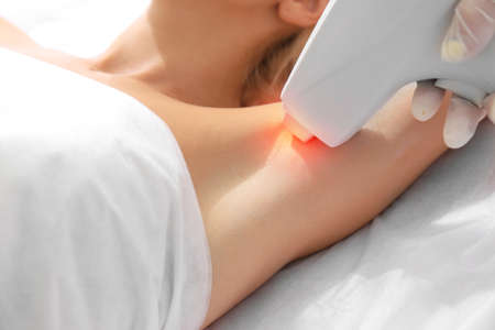 Woman on laser hair removal procedure at beauty salon. Epilation conceptの写真素材