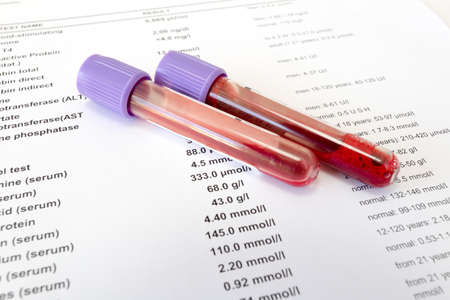 Red blood in test tubes on white blank with results in colums. The results are written in English.の写真素材