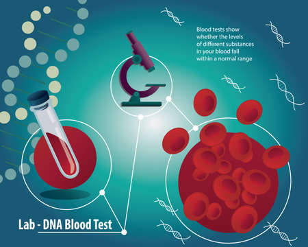 Blood test poster with medical laboratory equipment. Erythrocytes in the blood or RBCs for blood analises with microscope, DNA on blue backgroundのイラスト素材