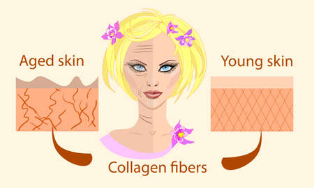 skin aging diagrams. young skin is firm tight, its collagen Vector illustration with a face and two types of skinのイラスト素材